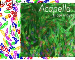 Acapella image analysis