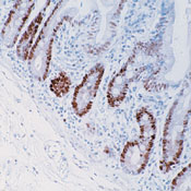     PCNA / PCNA (Proliferating Cell Nuclear Antigen) Ab-1