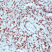      / Retinoblastoma (Rb) Ab-1