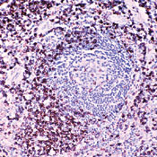     CD45RO ( T-) / CD45RO (T-Cell Marker) Ab-1