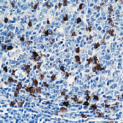     CD57 / CD57 (Natural Killer Cell Marker) Ab-1