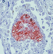       / Pneumocystis jiroveci (P. Carinii) Ab-1