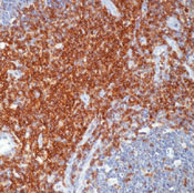     CD43 ( -) / CD43 / T-Cell Marker Ab-1
