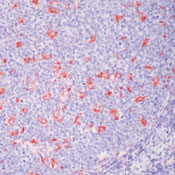     CD68 ( ),  PG-M1 / CD68 / Macrophage Marker Ab-4
