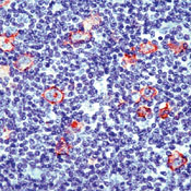     CD30 / CD30 (Reed-Sternberg Cell Marker) Ab-4