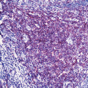     CD3epsilon (   )  / CD3epsilon (Early T-Cell Marker) Ab-9