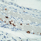      / Granulocyte (Myeloid cell Marker) Ab-1