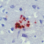        / Toxoplasma Gondii Ab-1
