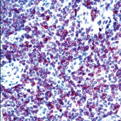      CD3epsilon / CD3epsilon (Early T-Cell Marker) Ab-1