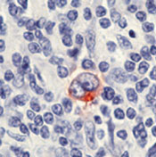    CD30 (  -) / CD30 (Reed-Sternberg Cell Marker) Ab-1