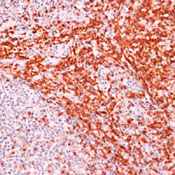     CD3epsilon / CD3epsilon (Early T-Cell Marker) Ab-2