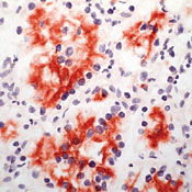     -  / Renal Cell Carcinoma Marker (gp200) Ab-1