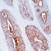     CEA / CEA (Carcinoembryonic Antigen) / CD66e Ab-3