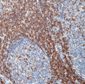     CD43 /    / CD43 / T-Cell Marker Ab-3