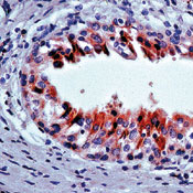      PSCA / PSCA (Prostate Stem Cell Antigen)