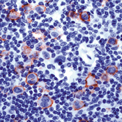     CD15  / CD15 sample