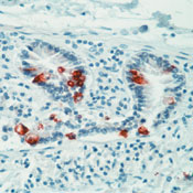      2 (MUC-2)  / Mucin 2 (MUC2) Ab-2