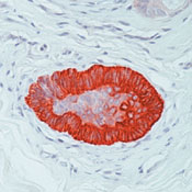     15  / Keratin 15 Ab-1
