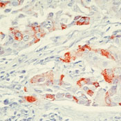    pS2 / pNR-2 -  / pS2 / pNR-2 Estrogen-Regulated Protein Ab-1