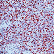       / Myogenin Ab-1