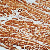       / Actin, Smooth Muscle Ab-1