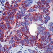     CD56/NCAM-1 / CD56 / NCAM-1 Ab-4  