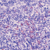       / Granzyme B Ab-1  