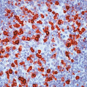     CD57 (   ) / CD57 (Natural Killer Cell Marker) Ab-2