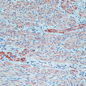      / Myosin, Smooth Muscle Heavy Chain Ab-1