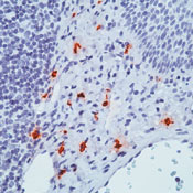         / Mast Cell Tryptase Ab-2