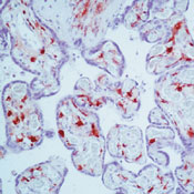      XIII / Factor XIII A Ab-1