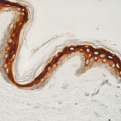      / Involucrin Ab-1