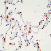        ( ) / Surfactant Protein B (Mature) Ab-2
