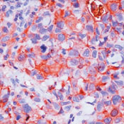       / Prolactin Receptor Ab-1