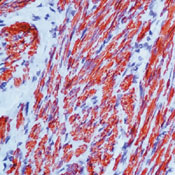          / Myosin, Smooth Muscle Heavy Chain Ab-3