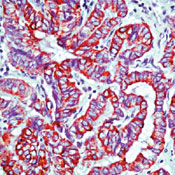      7 / Keratin 7 Ab-2