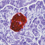      / Insulin Ab-6 (INS04 + INS05)  