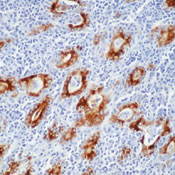     / Thyroglobulin Ab-6