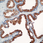         / Prostate Specific Antigen (PSA) Ab-6  
