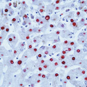          / Hepatitis B Virus Core Antigen (HBVcAg) Ab-1  