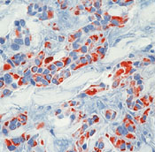      18 () / Keratin 18 Ab-1
