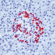       / Glucagon Ab-1