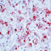         / Herpes Simplex Virus Type 2 (HSV II) Ab-1