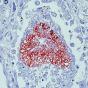       / Pneumocystis jiroveci (P. Carinii) Ab-1  