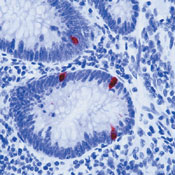     / Serotonin Ab-1  