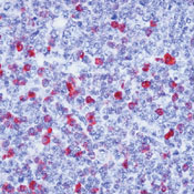       G / IgG (gamma-Heavy Chain) Ab-1