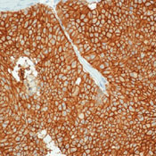        / Epithelial Specific Antigen / Ep-CAM Ab-1  