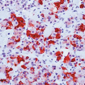       / Follicle Stimulating Hormone (FSH) Ab-3  