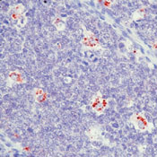      - / Epstein-Barr Virus / LMP Ab-1 