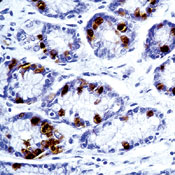       / Gastrin Ab-1